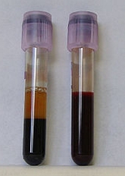 Blood For Lab Testing