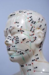 Acupunture Model Showing Needle Positions