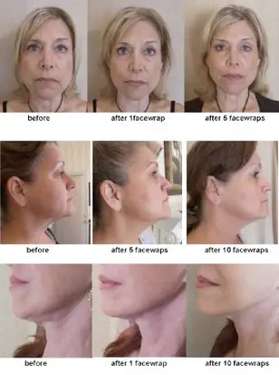 Before & After Results ©2007 - 2011 The Face Wrap. All Rights Reserved.
