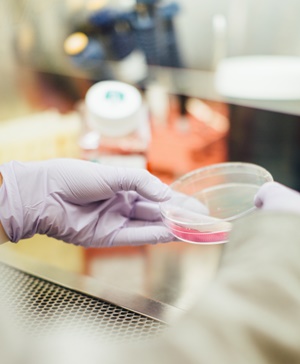 Are PRP Treatments Real Or A Hair Loss Scam?