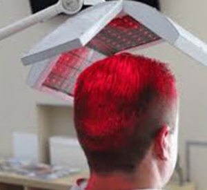 Does Light Therapy Help Female Baldness?